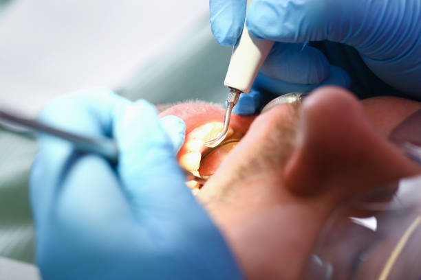 Best Emergency Dental Surgery in Paola, KS